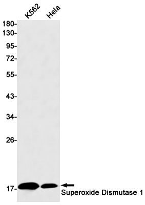 Superoxide Dismutase 1