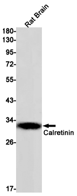 Calretinin