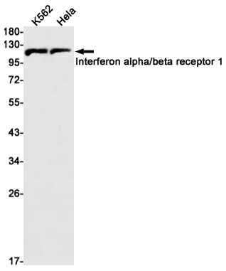 Interferon alpha/beta Receptor 1