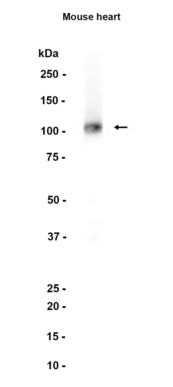 Ionotropic Glutamate receptor 2