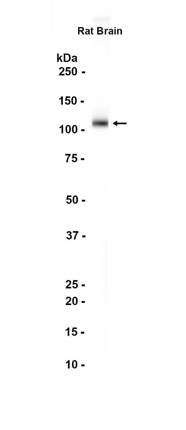 AMPA Receptor 4 (GluA 4)