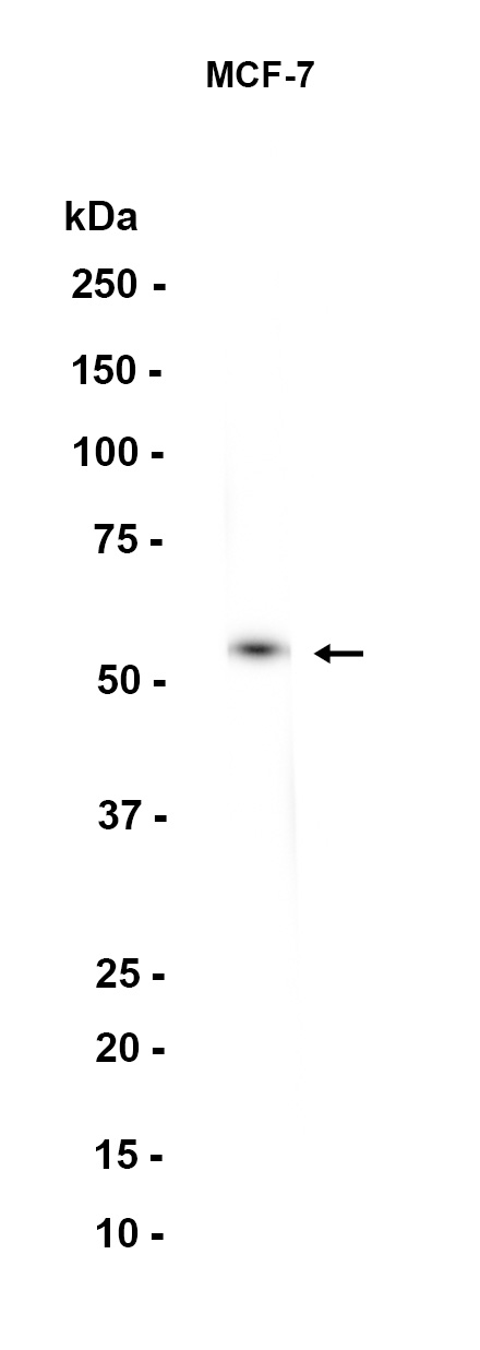 Lipoamide Dehydrogenase
