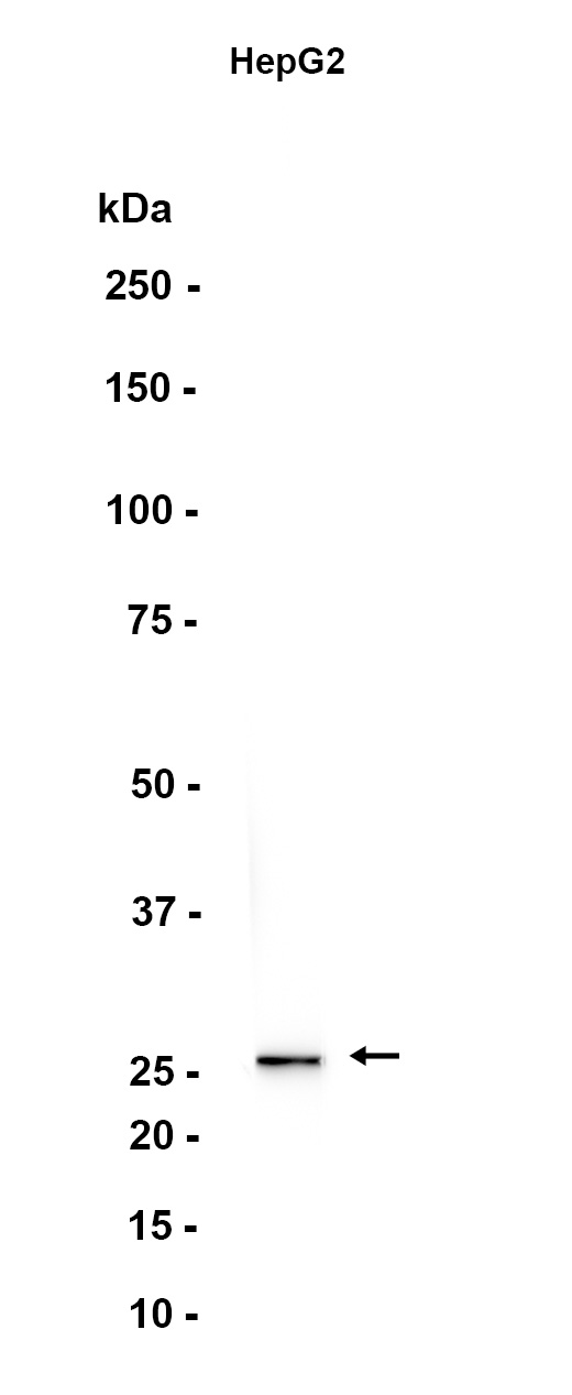 Proteasome 20S alpha 5/PSMA5