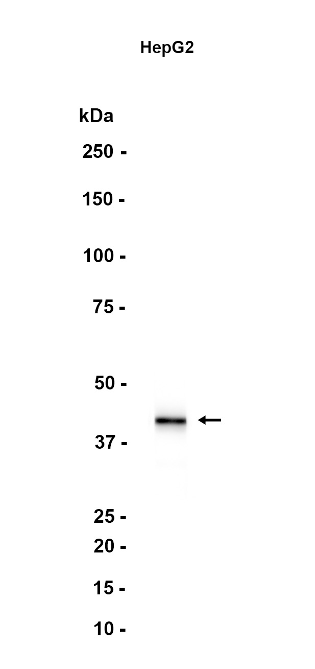 Apolipoprotein L 1