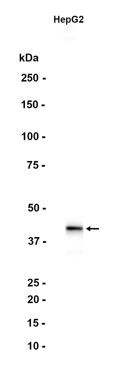 Apolipoprotein L 1
