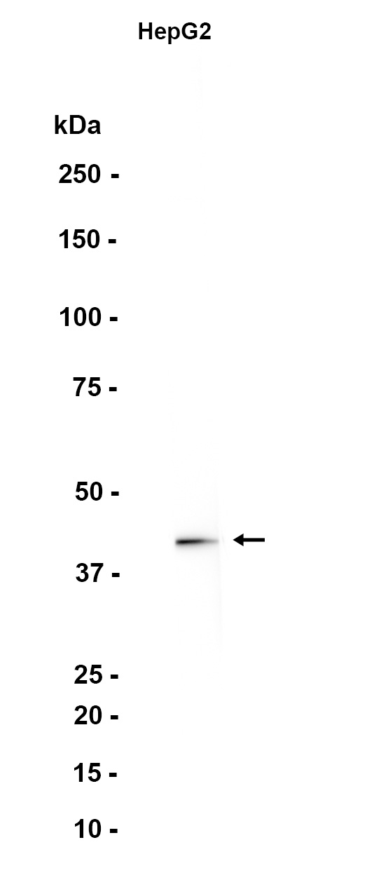Apolipoprotein L 1