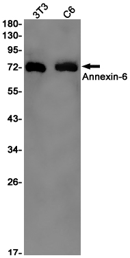 Annexin VI