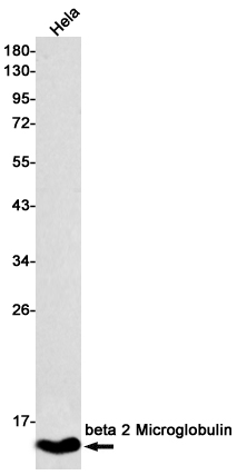 beta 2 Microglobulin