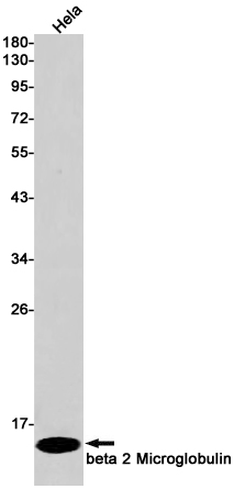 beta 2 Microglobulin