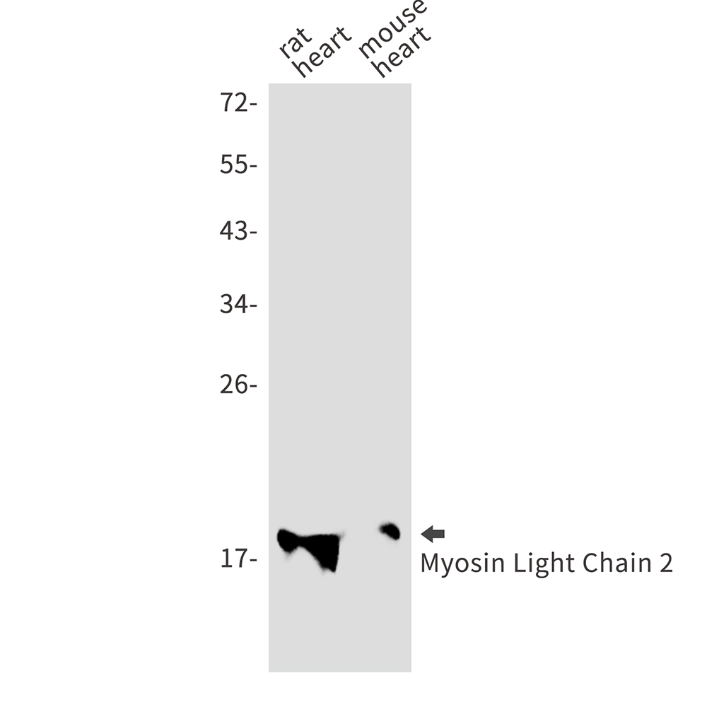 Myosin Light Chain 2