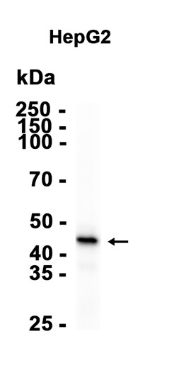 Phospho~Pyruvate Dehydrogenase E1~alpha subunit (Ser293)