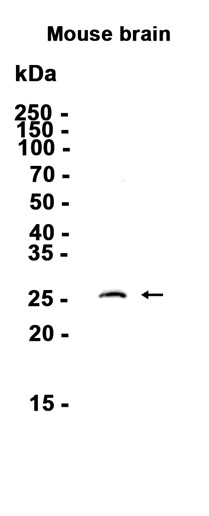 Phospho~Bcl~2 (Ser70)