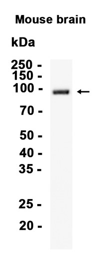 Phospho~PSD95 (Ser418)