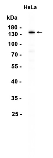 Phospho~Topoisomerase II alpha (Thr1343)