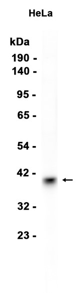 Phospho~Nucleophosmin (Thr95)