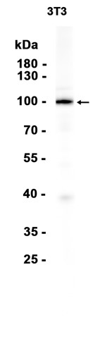 Ubiquitin Protein Ligase E3A