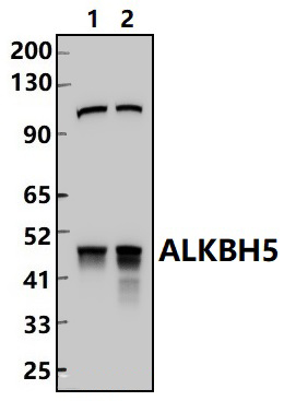 ALKBH5