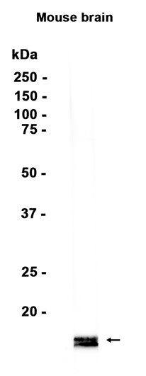 alpha/beta Synuclein
