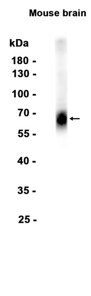 Somatostatin Receptor 2