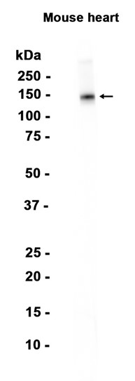 Natriuretic Peptide Receptor B