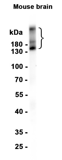 Metabotropic Glutamate Receptor 5