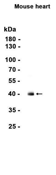 Cardiac Troponin T