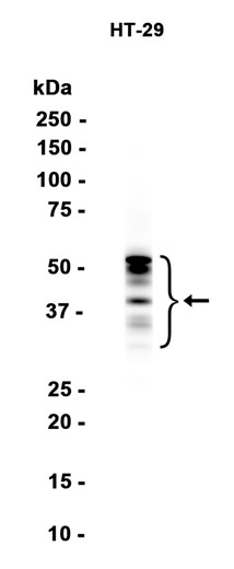 Carbonic Anhydrase IX