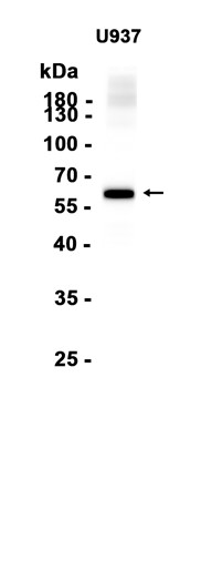 Liver Carboxylesterase 1