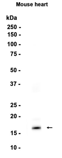 Natriuretic peptides A