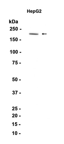 Proteasome Activator Subunit 4