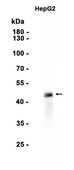 Prostacyclin receptor