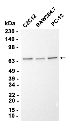 Natriuretic Peptide Receptor C