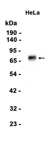 Extracellular matrix protein 1