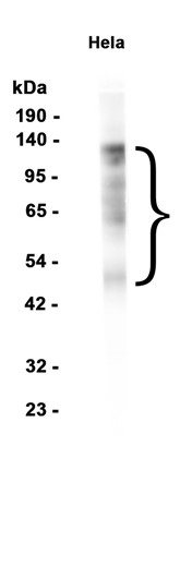 PML Protein
