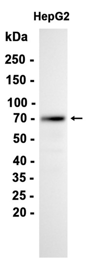alpha 1 Fetoprotein
