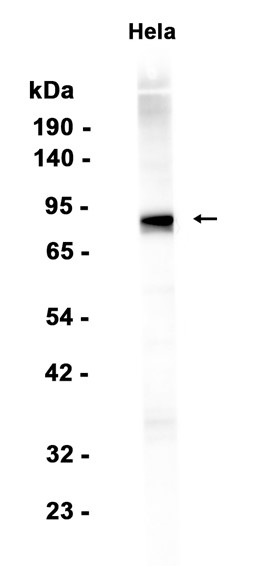 Rsk 2/MAPKAP Kinase 1b