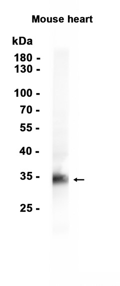 gamma Sarcoglycan