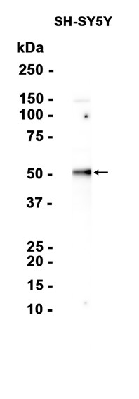 Argininosuccinate Lyase