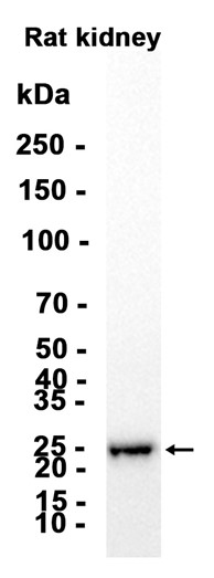 Glutathione Peroxidase 3/GPx~3