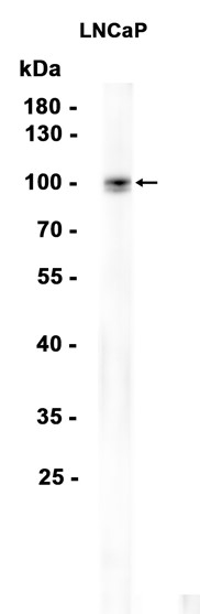 Prostate Specific Membrane Antigen