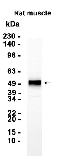 alpha Sarcoglycan