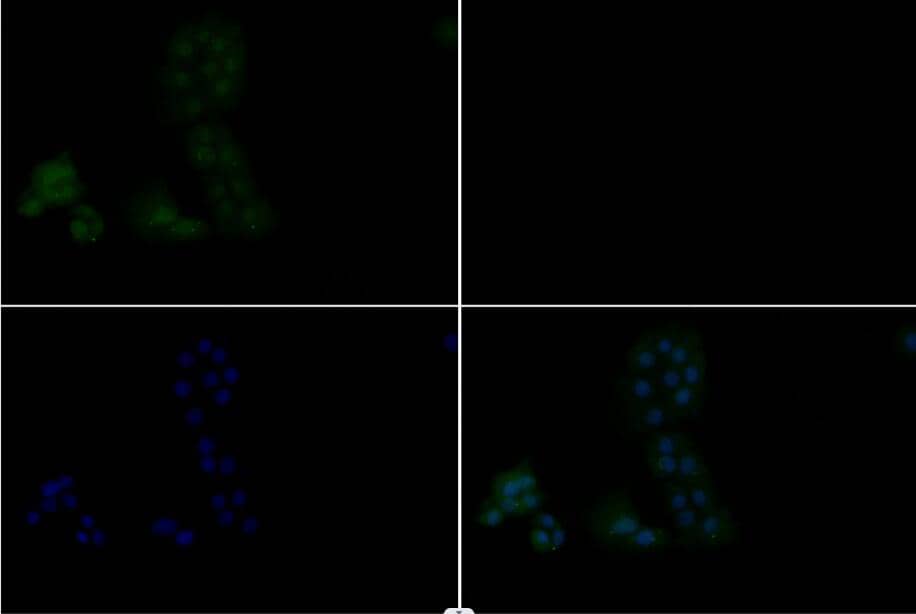Rabbit polyclonal antibody to AKT (phospho~T308)