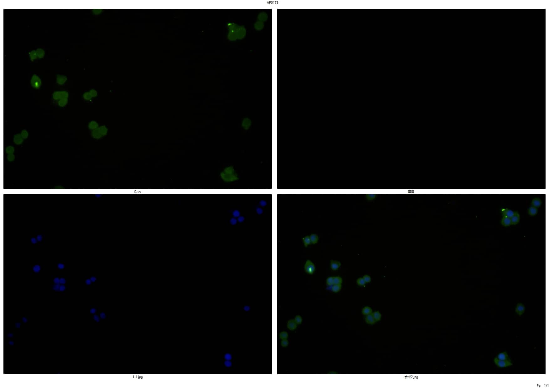 Rabbit polyclonal antibody to mT0R (Ser2481)