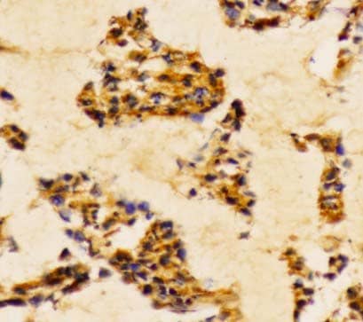 Rabbit polyclonal antibody to PI3K p85α/p55γ (Y467/199)