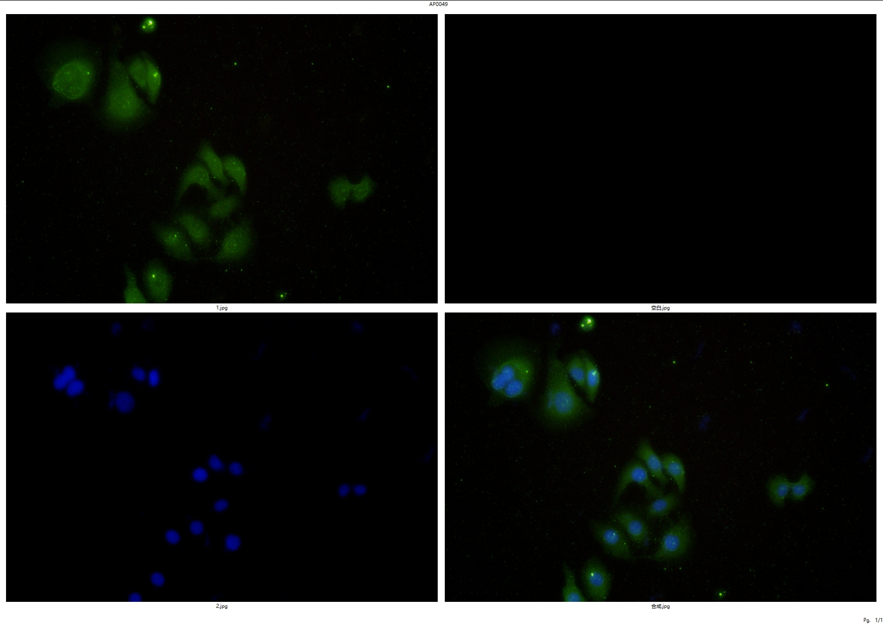 Rabbit polyclonal antibody to ERK1/2 (Y204)