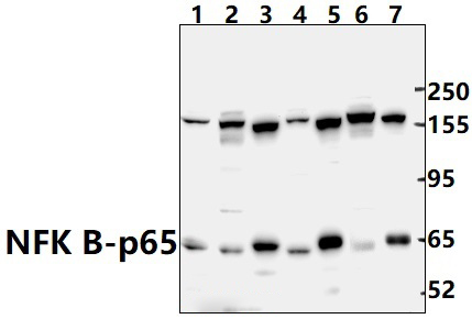 NFKB~p65