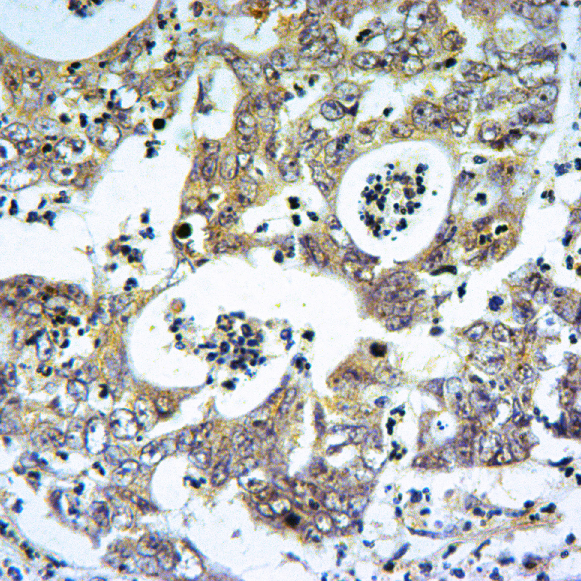 Rabbit polyclonal antibody to mT0R (Ser2481)