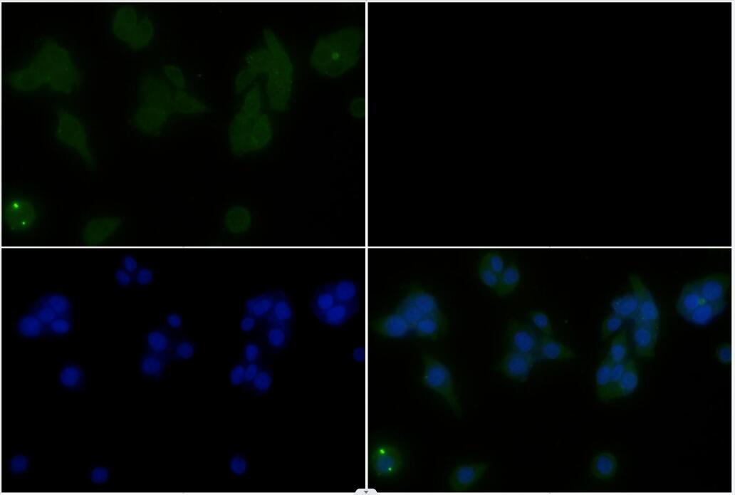 Rabbit polyclonal antibody to p38 MAPK(Thr179+Tyr181)