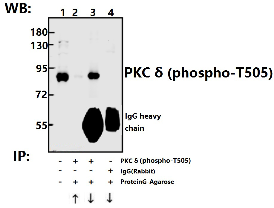 Rabbit polyclonal antibody to PKC δ (phospho~T505)