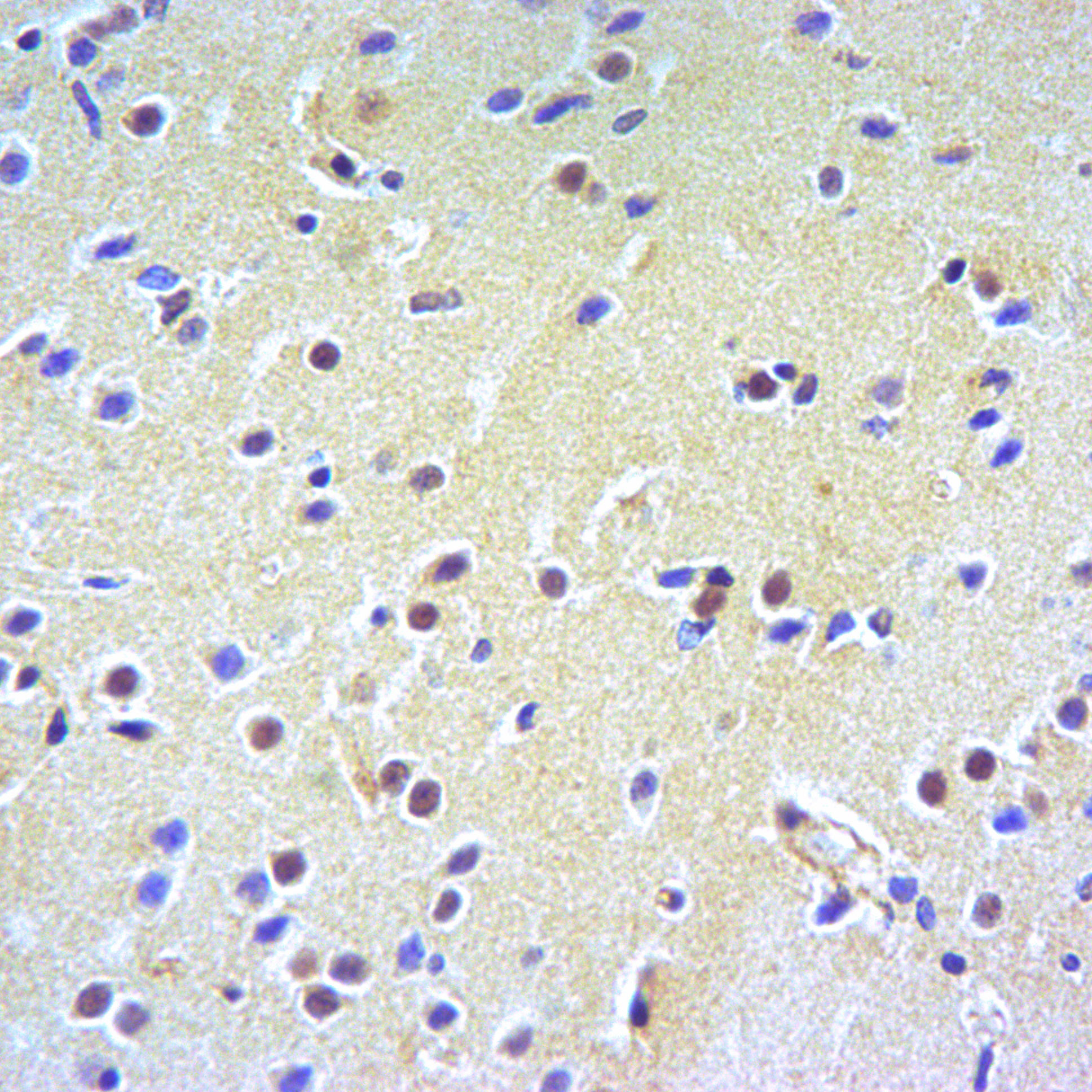 Rabbit polyclonal antibody to ERK1/2 (Y204)